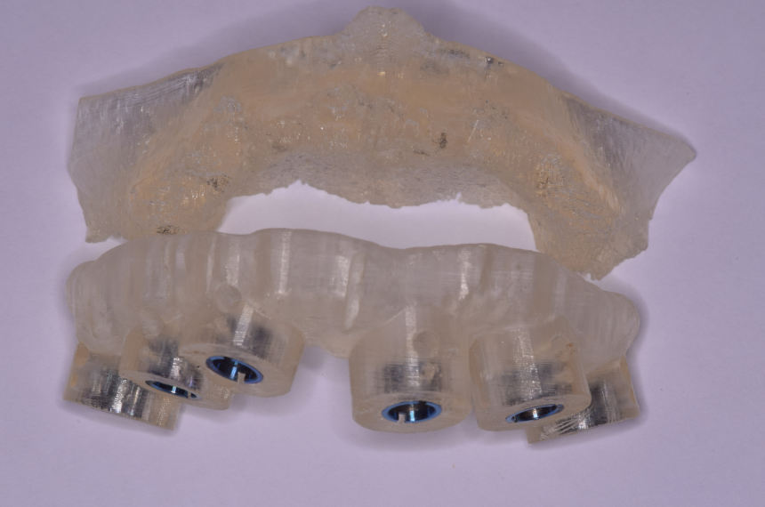 periodontologos ampelokipoi athina delendas emfyteymata